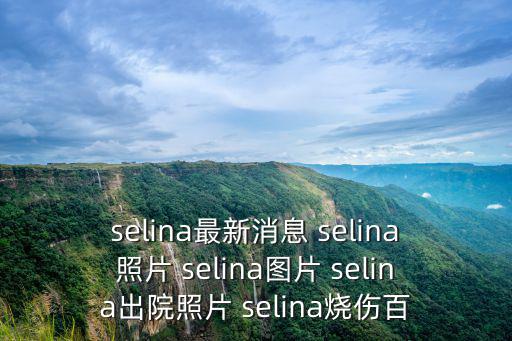 selina最新消息 selina照片 selina圖片 selina出院照片 selina燒傷百