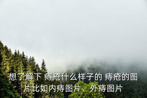 想了解下 痔瘡什么樣子的 痔瘡的圖片比如內痔圖片、外痔圖片