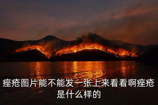 痤瘡圖片能不能發一張上來看看啊痤瘡是什么樣的