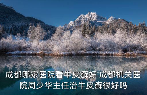 成都哪家醫院看牛皮癬好 成都機關醫院周少華主任治牛皮癬很好嗎