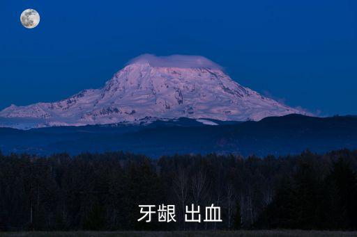  牙齦 出血