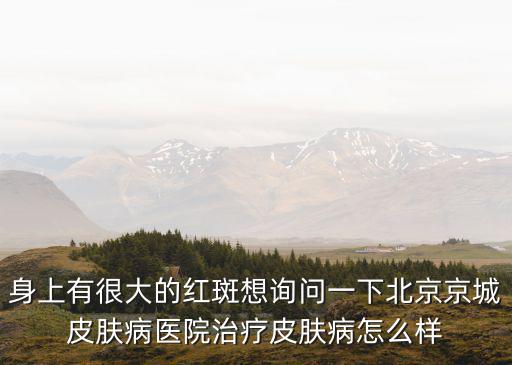 身上有很大的紅斑想詢問一下北京京城皮膚病醫院治療皮膚病怎么樣