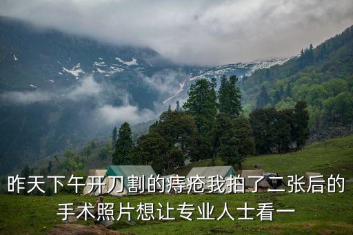 痔瘡手術圖片，請專家幫忙看看這是痔瘡嗎還是別的什么