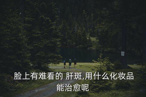 臉上肝斑圖片,臉部出現黃褐斑主要原因是遺傳因素