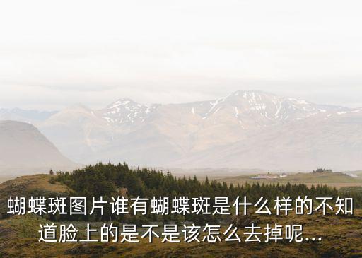 蝴蝶斑圖片誰有蝴蝶斑是什么樣的不知道臉上的是不是該怎么去掉呢...