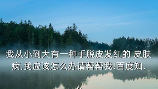 手皮膚病,只有中藥才能徹底根除手腳脫皮原因很多