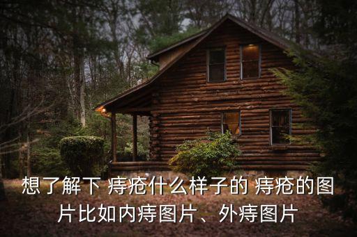 想了解下 痔瘡什么樣子的 痔瘡的圖片比如內痔圖片、外痔圖片