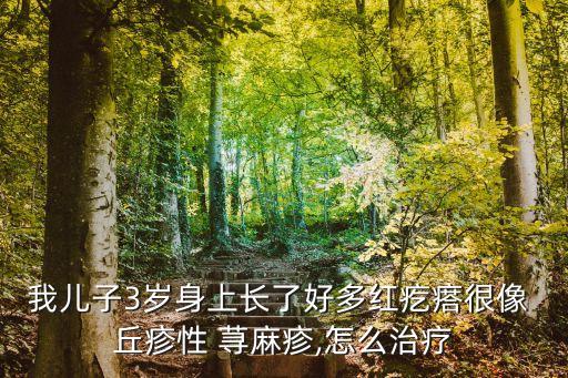 小兒丘疹性蕁麻疹