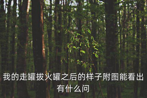 廣州拔罐針刺，我的走罐拔火罐之后的樣子附圖能看出有什么問