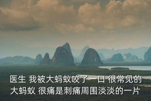 醫(yī)生 我被大螞蟻咬了一口 很常見的大螞蟻 很痛是刺痛周圍淡淡的一片