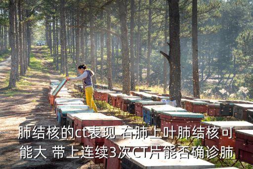肺結(jié)核的ct表現(xiàn) 右肺上葉肺結(jié)核可能大 帶上連續(xù)3次CT片能否確診肺